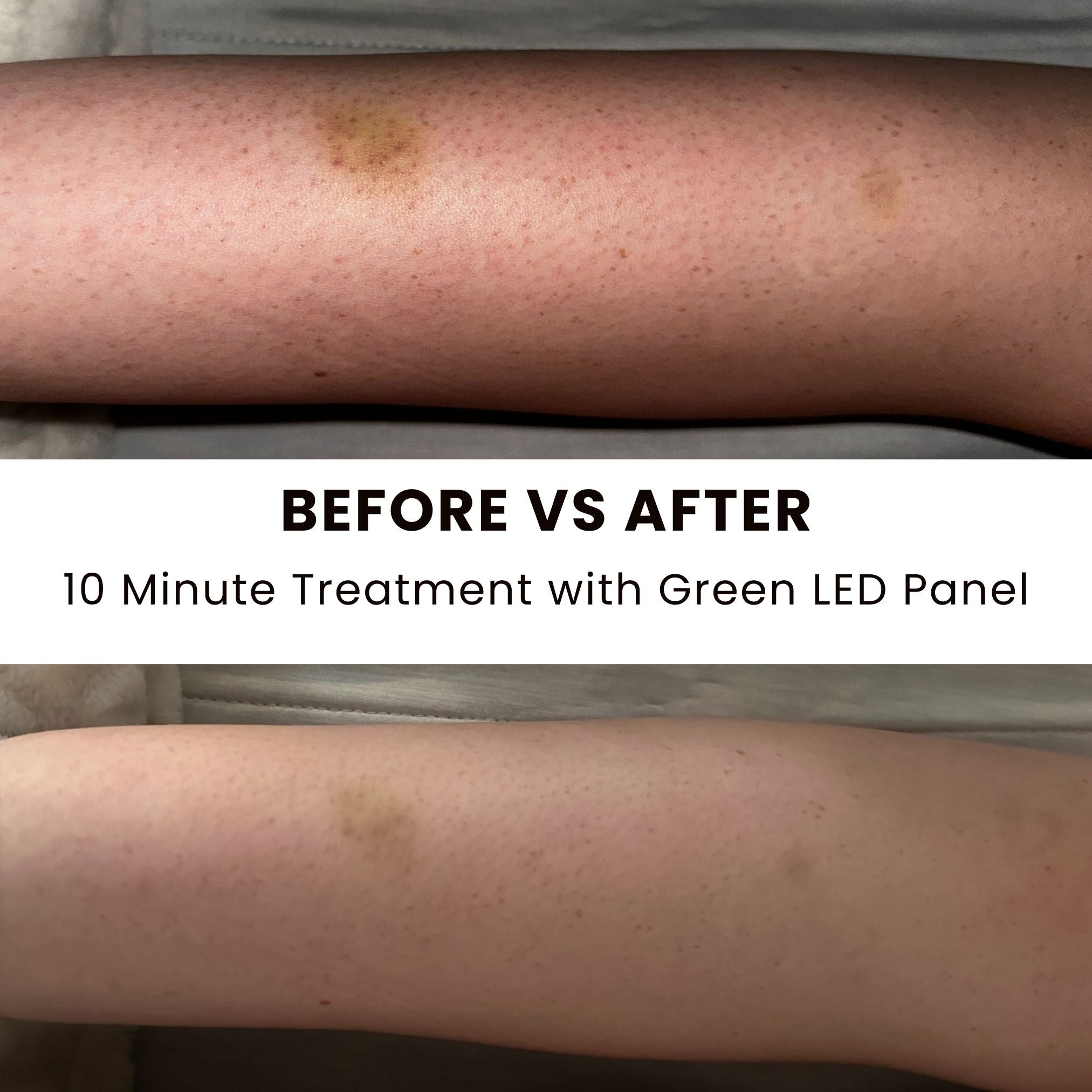 Lumara™ Illuminate LED Light Therapy Panel - Illuminate Green